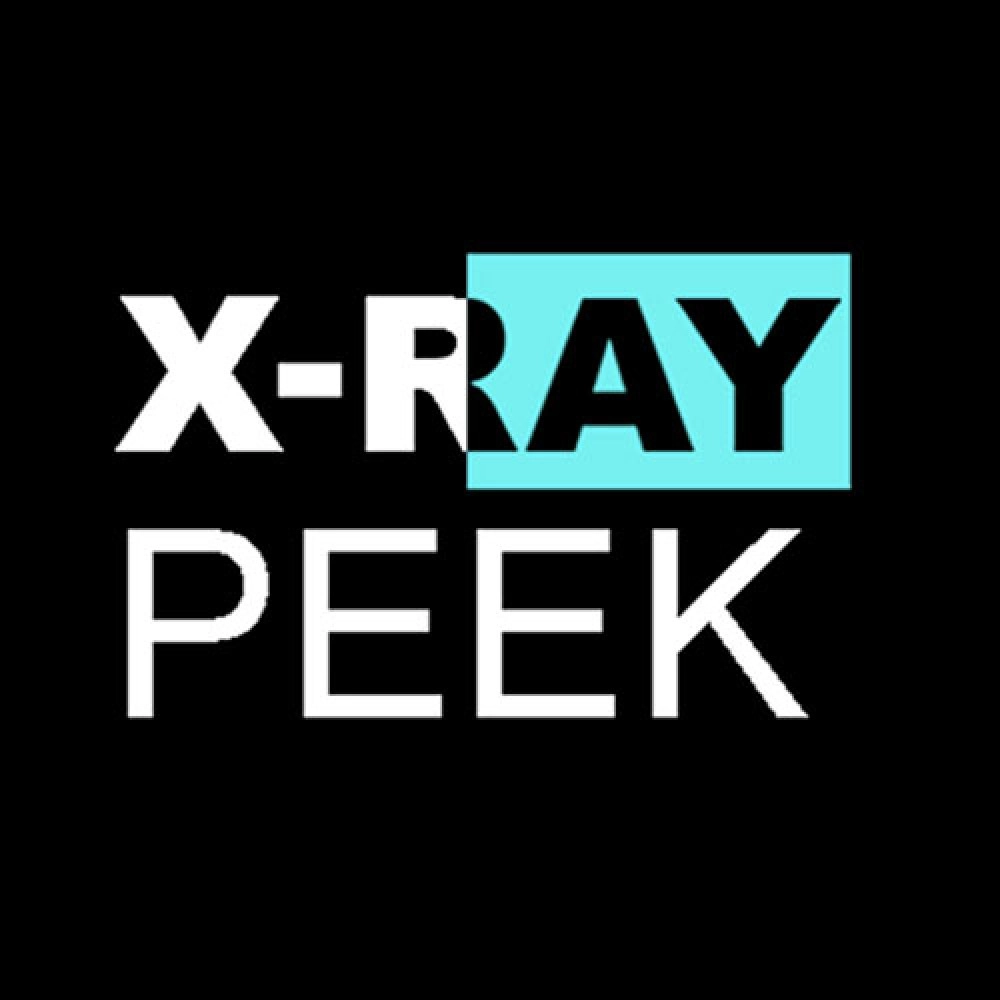 X-Ray Peek by Michel